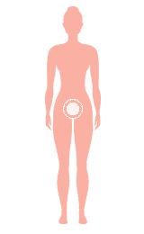 sihouette-cancer_uterus