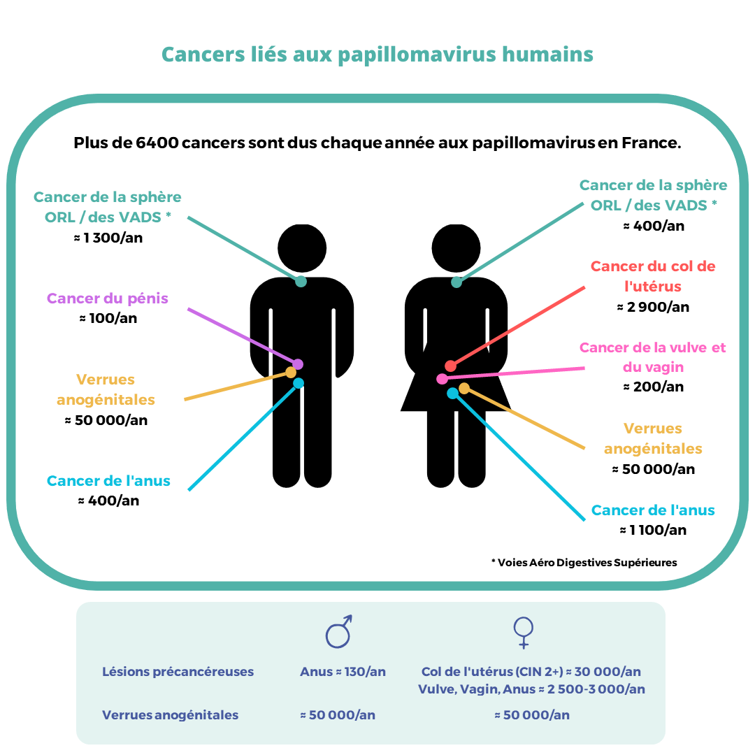 Cancers liés aux papillomavirus. Source : Données officielles du CIRC 2018 Fractions attribuables - Infographie réalisée par nos soins, 2023