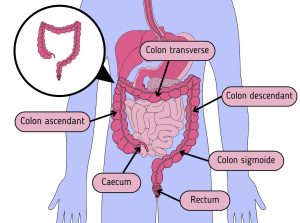 Cancer colorectal et facteurs de risque • Cancer Environnement
