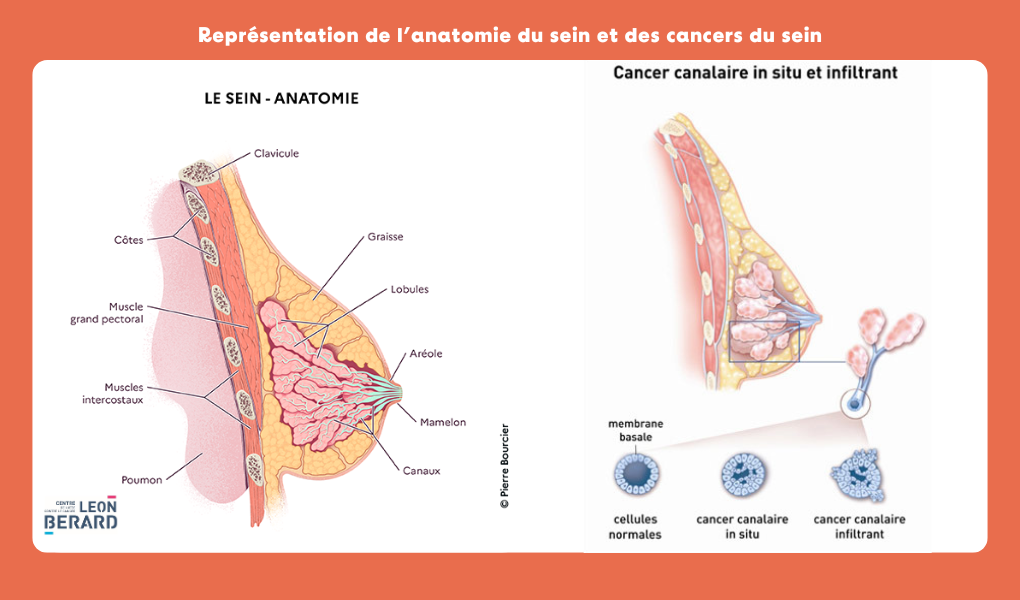 Représentation anatomique du sein et Cancers du sein